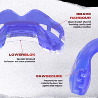 Safejawz Staffe Braces Mouthguard